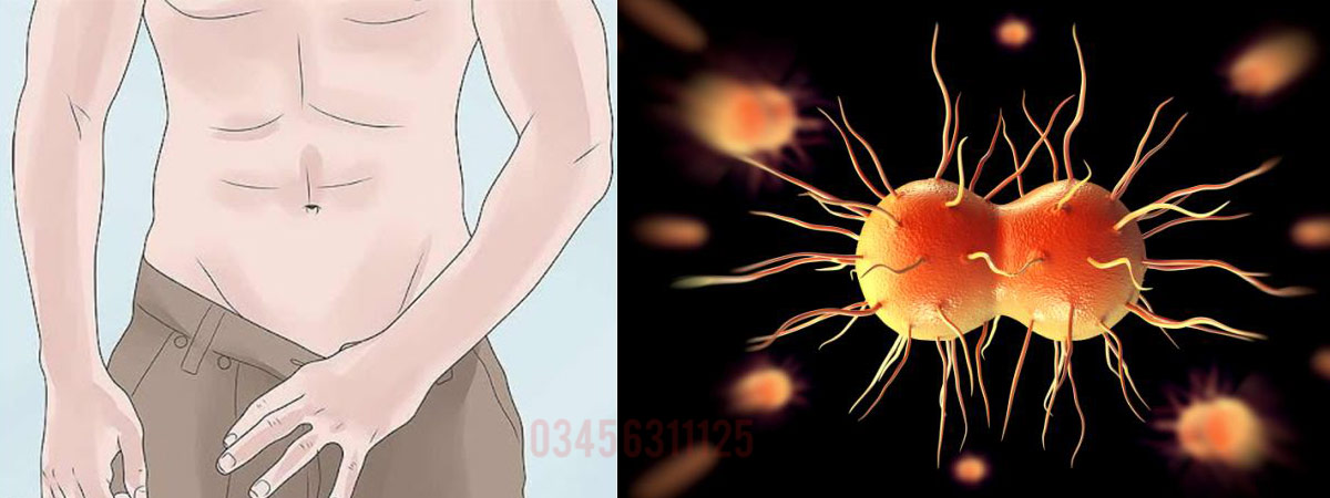 Gonorrhea Causes, Symptoms and Treatment